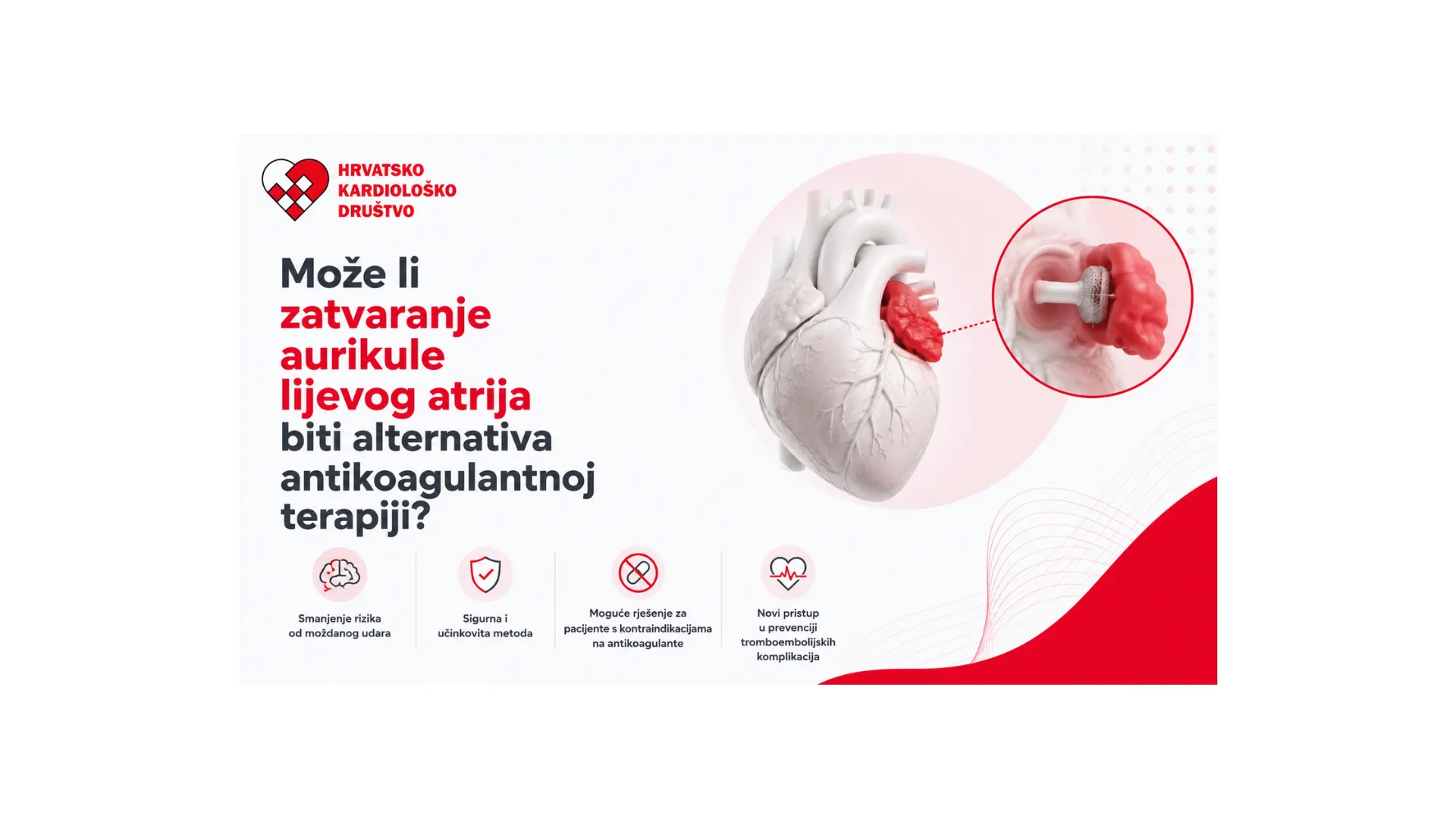Zatvaranje aurikule lijevog atrija ili oralna antikoagulantna terapija – što pokazuje novo istraživanje?